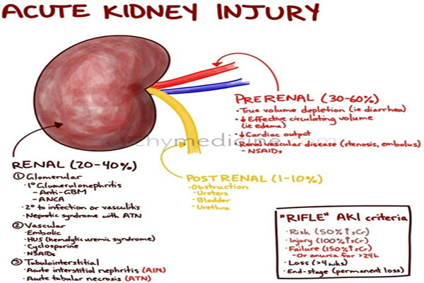 Severe, acute kidney injuries in humans double due to GMO foods